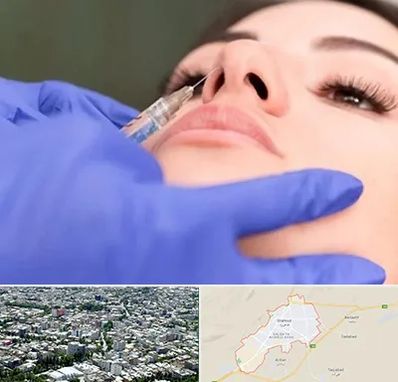 هیالاز در شاهرود