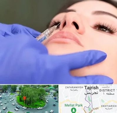 هیالاز در تجریش 