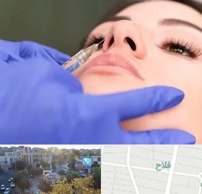 هیالاز در فلاح