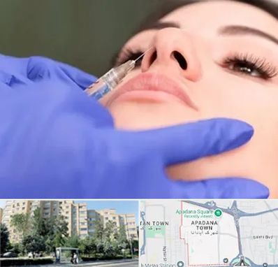 هیالاز در آپادانا