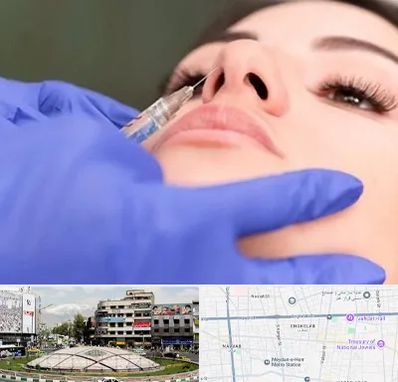 هیالاز در مرکز تهران