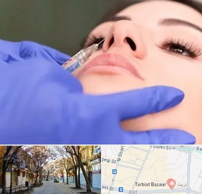 هیالاز در تربیت تبریز