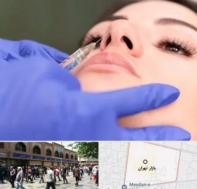 هیالاز در بازار تهران