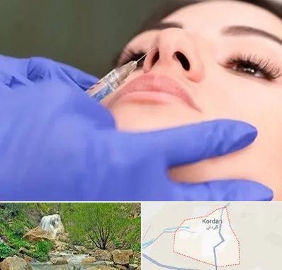 هیالاز در کردان