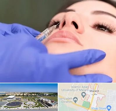 هیالاز در ملارد