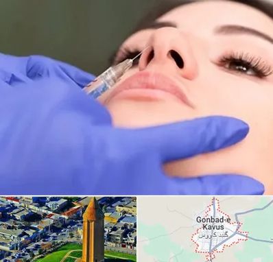 هیالاز در گنبد کاووس