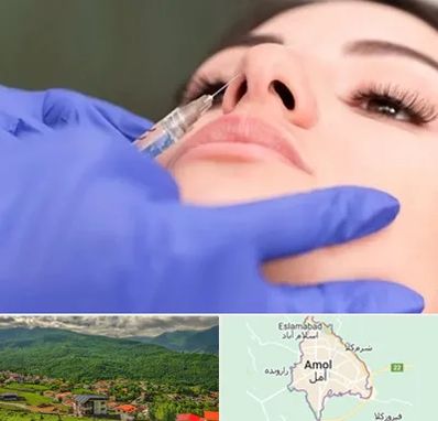 هیالاز در آمل