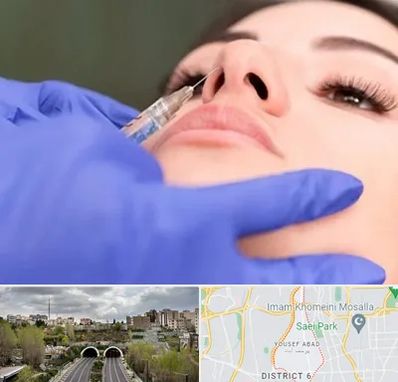 هیالاز در یوسف آباد 