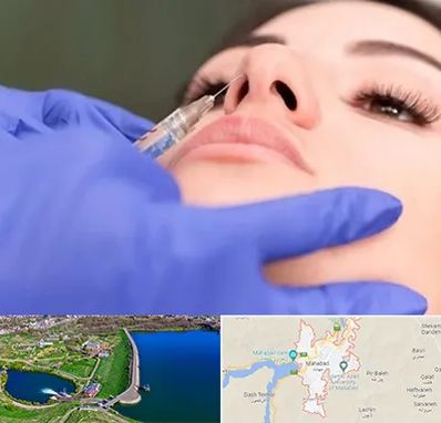 هیالاز در مهاباد