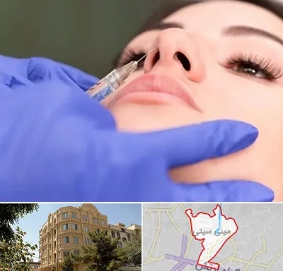 هیالاز در مینی سیتی