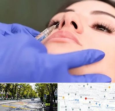 هیالاز در میرداماد 