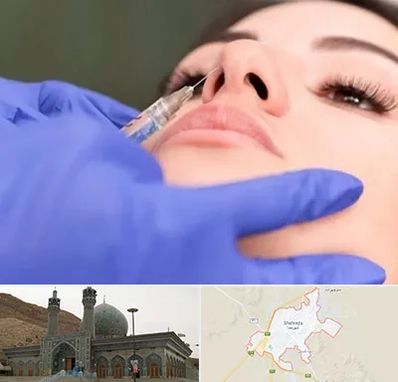 هیالاز در شهرضا