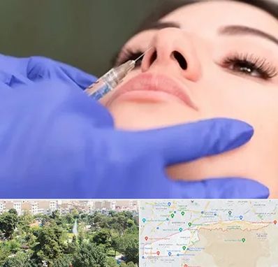 هیالاز در منطقه 13 تهران 