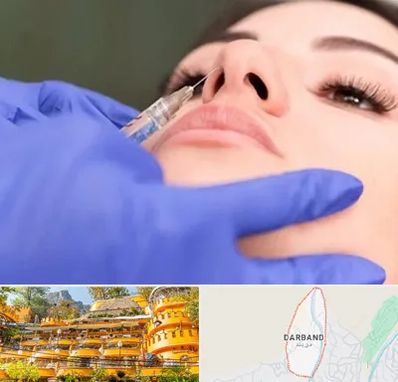 هیالاز در دربند