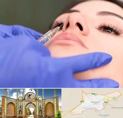 هیالاز در سمنان