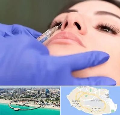 هیالاز در کیش