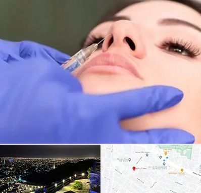 هیالاز در هفت تیر مشهد 