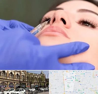 هیالاز در منطقه 11 تهران 