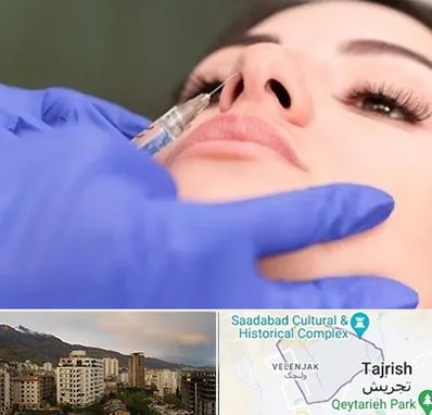 هیالاز در زعفرانیه 