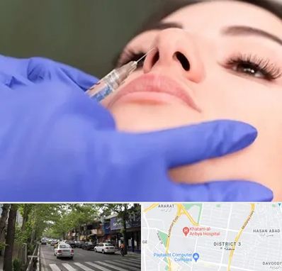 هیالاز در ظفر 