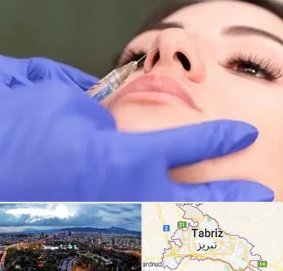 هیالاز در تبریز