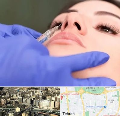 هیالاز در مرزداران 