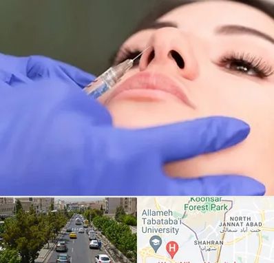 هیالاز در شهران 