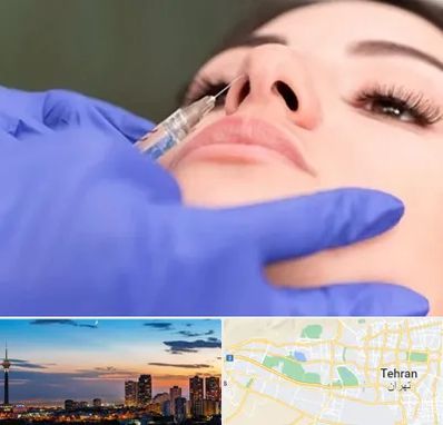 هیالاز در غرب تهران 