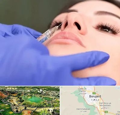 هیالاز در بروجرد