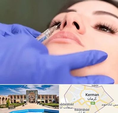 هیالاز در کرمان