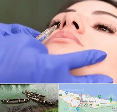 هیالاز در بندر انزلی