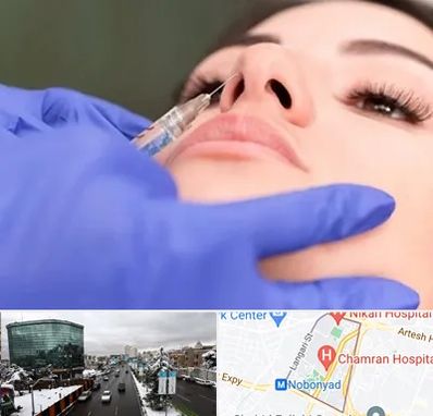 هیالاز در اقدسیه 