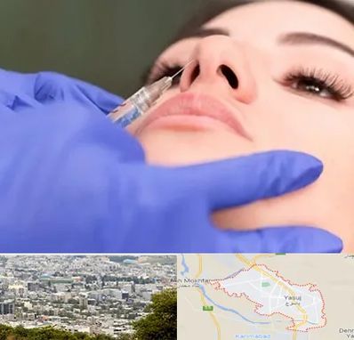 هیالاز در یاسوج