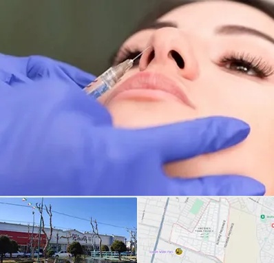 هیالاز در فاز دو اندیشه