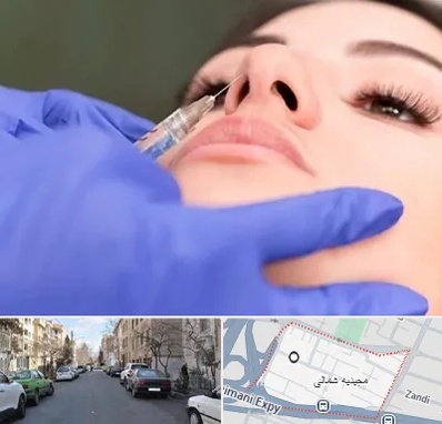 هیالاز در مجیدیه شمالی