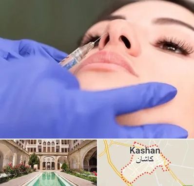 هیالاز در کاشان