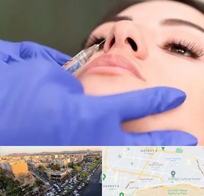 هیالاز در تهرانپارس 