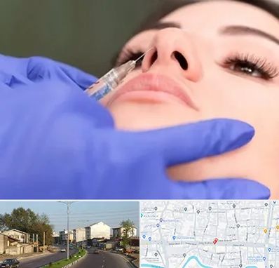 هیالاز در ضیابری رشت