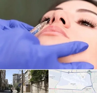 هیالاز در مهرآباد