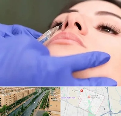 هیالاز در فاز سه اندیشه