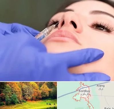 هیالاز در کردکوی
