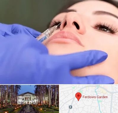 هیالاز در باغ فردوس