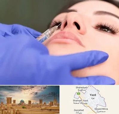 هیالاز در یزد