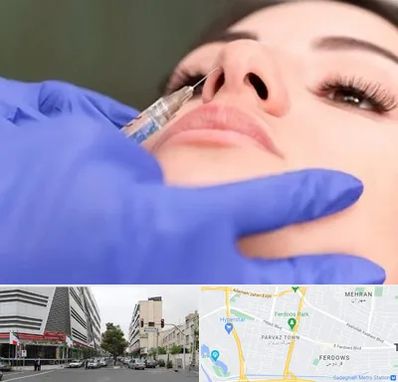 هیالاز در بلوار فردوس 