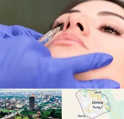 هیالاز در ارومیه