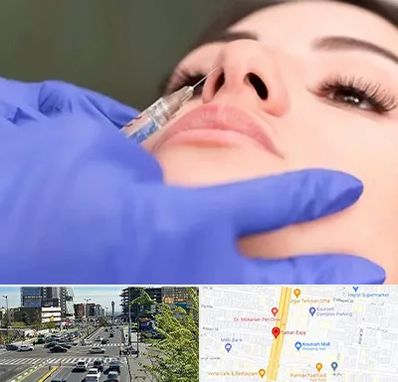 هیالاز در ستاری 