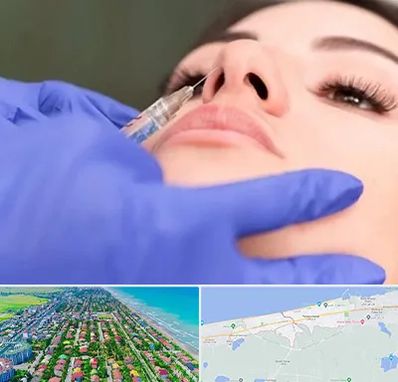 هیالاز در فریدونکنار