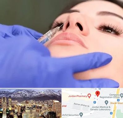 هیالاز در جردن 