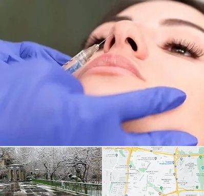 هیالاز در باغ فیض