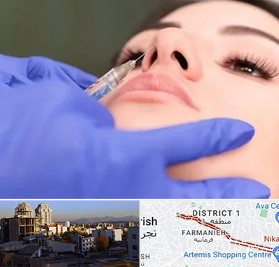 هیالاز در فرمانیه 